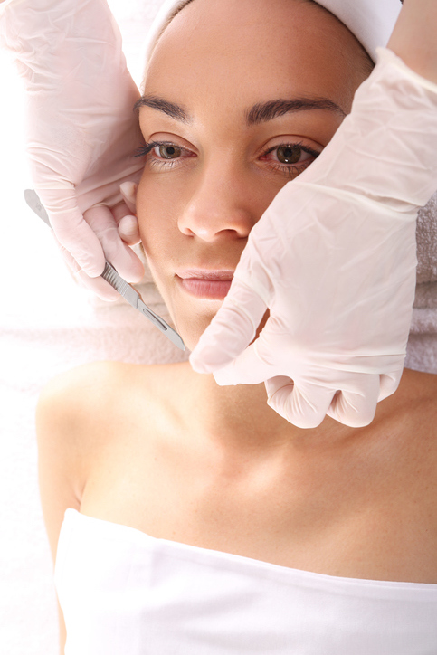 Exfoliating the skin with a scalpel