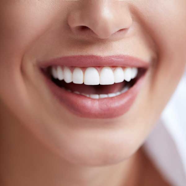 teeth-whitening